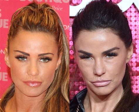 katie price before surgery|Unrecognisable: Katie Price Before And After Plastic Surgery.